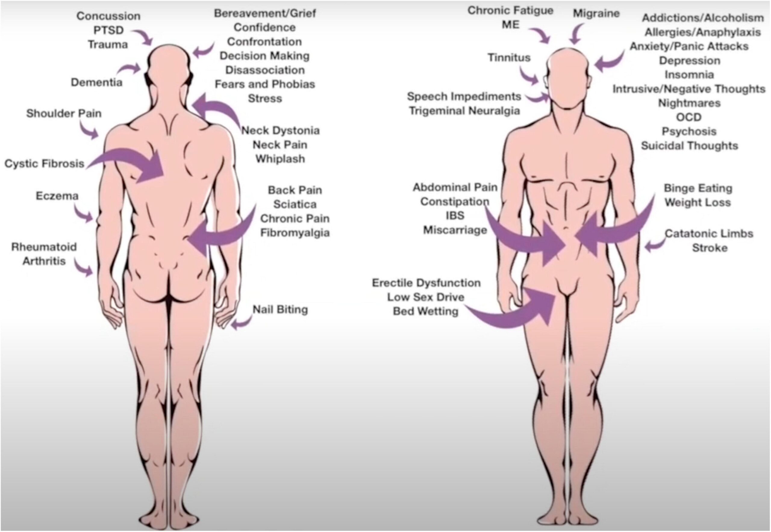 Fibromyalgia notable studies - MEpedia